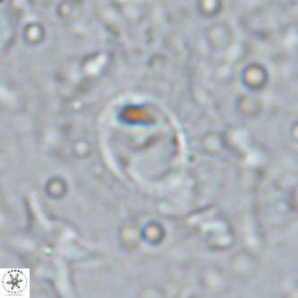 Hughesius synchysi VR 16616
