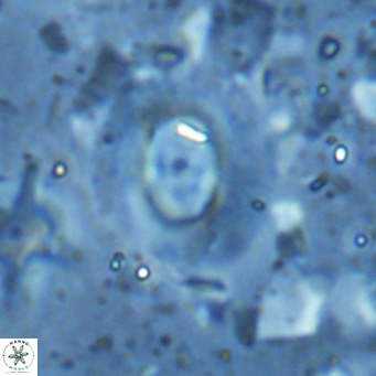 Hughesius synchysi VR 16618