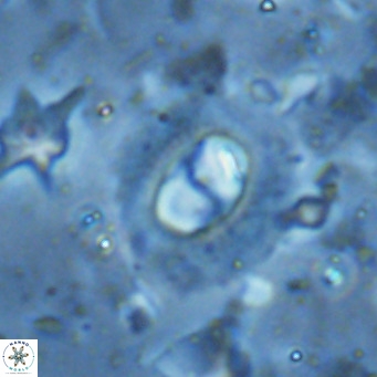 Hughesius synchysi VR 16620