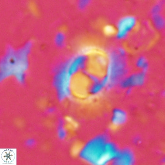 Hughesius synchysi VR 16628