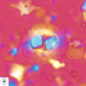 Hughesius synchysi VR 16632