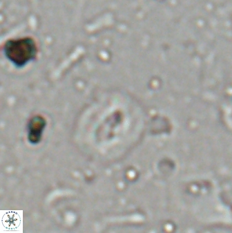 Hughesius tasmaniae 27844