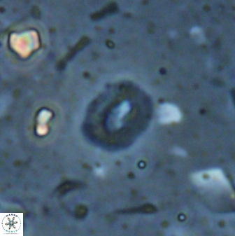 Hughesius tasmaniae 27846