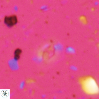 Hughesius tasmaniae 27841