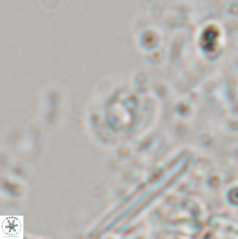 Hughesius tasmaniae 22749