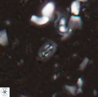 Hughesius youngii 27875