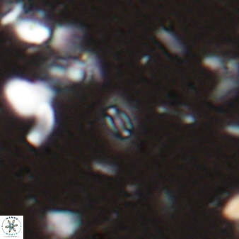 Hughesius youngii 27879