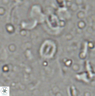 Hughesius youngii 27880