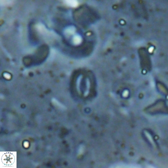 Hughesius youngii 27882