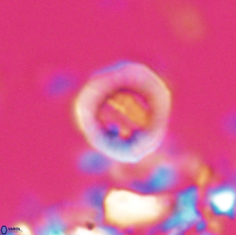 Hypsiteicholithus polymerus 22358