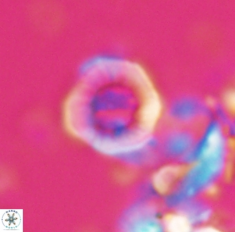Hypsiteicholithus polymerus 22359