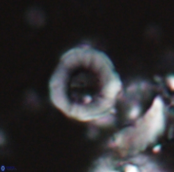 Hypsiteicholithus polymerus 22360