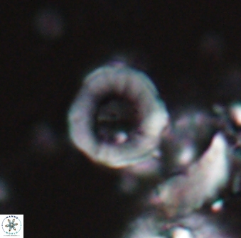 Hypsiteicholithus polymerus 22360