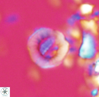 Hypsiteicholithus polymerus 22362