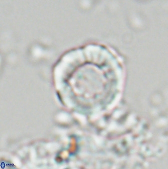 Hypsiteicholithus polymerus 22364