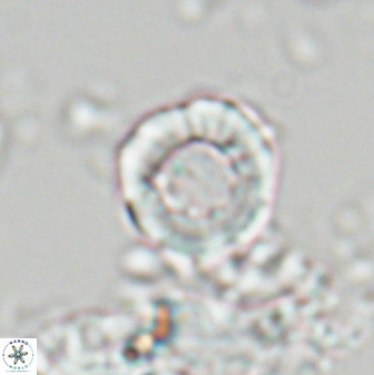 Hypsiteicholithus polymerus 22364