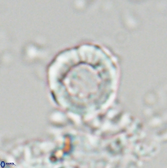 Hypsiteicholithus polymerus 22365