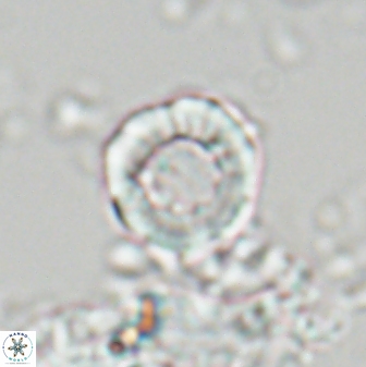Hypsiteicholithus polymerus 22365