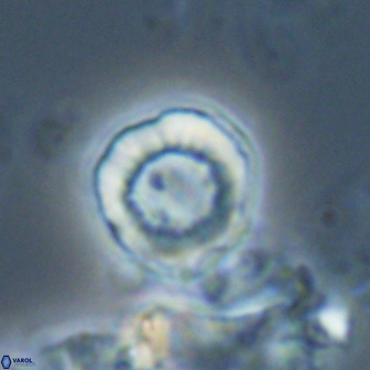 Hypsiteicholithus polymerus 22366