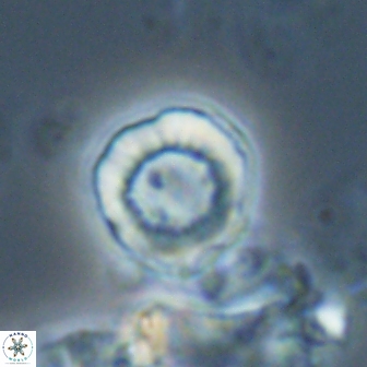Hypsiteicholithus polymerus 22366