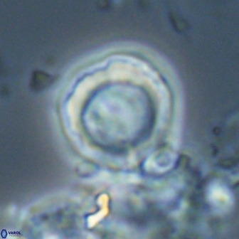 Hypsiteicholithus polymerus 22367