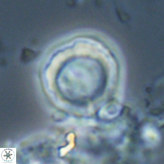 Hypsiteicholithus polymerus 22367