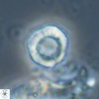 Hypsiteicholithus polymerus 22368