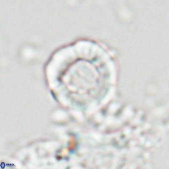 Hypsiteicholithus polymerus 22369