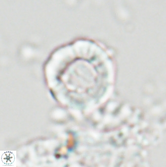 Hypsiteicholithus polymerus 22369