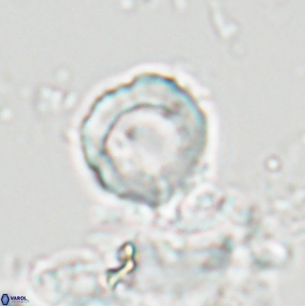 Hypsiteicholithus polymerus 22370