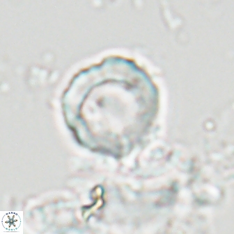 Hypsiteicholithus polymerus 22370