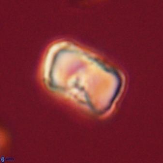 Hypsiteicholithus polymerus 61512 1