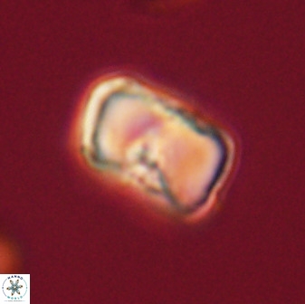 Hypsiteicholithus polymerus 61512 1