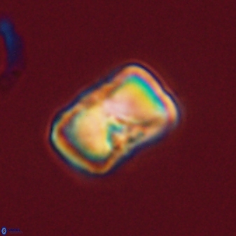 Hypsiteicholithus polymerus 61514