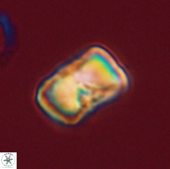 Hypsiteicholithus polymerus 61514