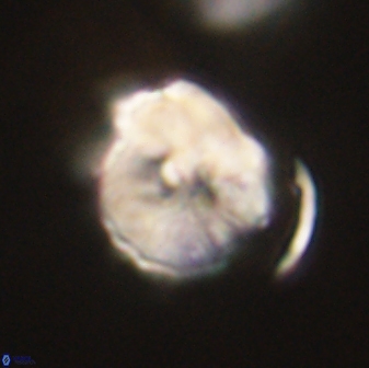 Hypsiteicholithus polymerus 61515