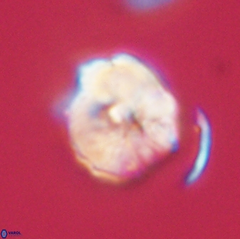 Hypsiteicholithus polymerus 61516