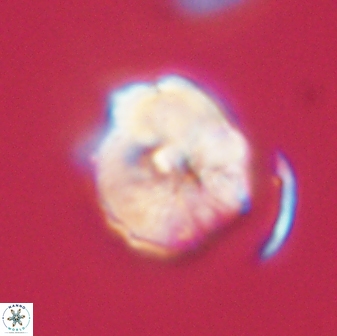 Hypsiteicholithus polymerus 61516