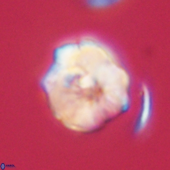 Hypsiteicholithus polymerus 61517