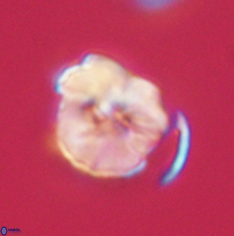 Hypsiteicholithus polymerus 61520