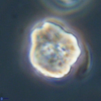 Hypsiteicholithus polymerus 61526