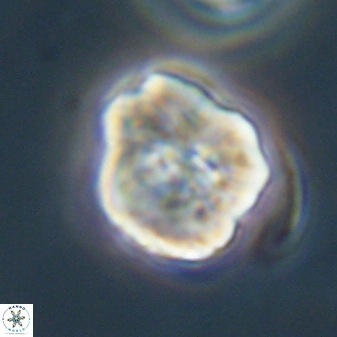 Hypsiteicholithus polymerus 61526