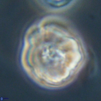 Hypsiteicholithus polymerus 61527