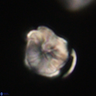 Hypsiteicholithus polymerus 61529