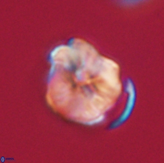 Hypsiteicholithus polymerus 61530