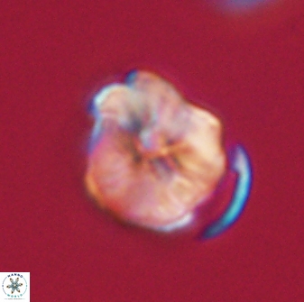 Hypsiteicholithus polymerus 61530
