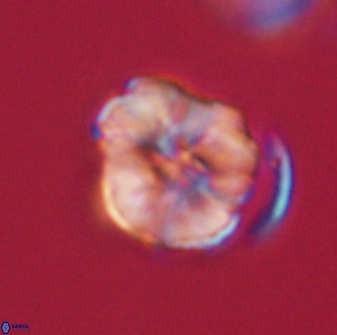 Hypsiteicholithus polymerus 61532