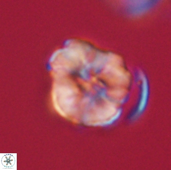 Hypsiteicholithus polymerus 61532