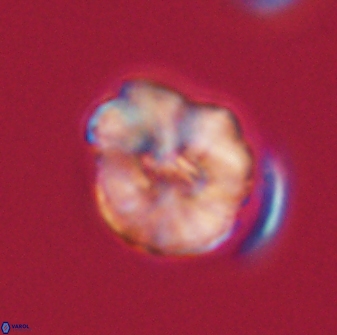 Hypsiteicholithus polymerus 61534