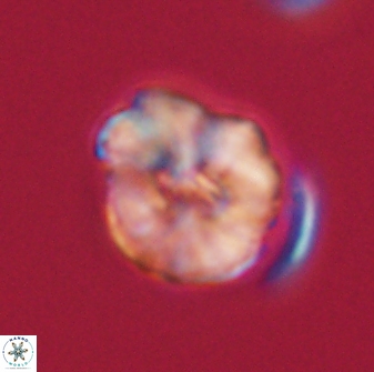 Hypsiteicholithus polymerus 61534
